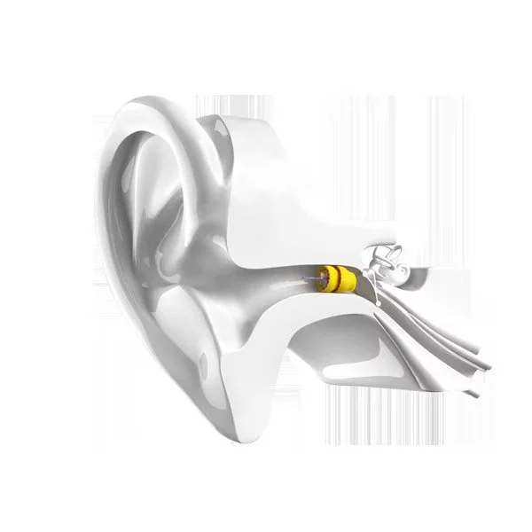 lyric-ear-model-phonak